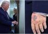 Η εξήγηση για τη νέα τεράστια μελανιά στο χέρι του Τραμπ – «Είναι παρενέργεια»